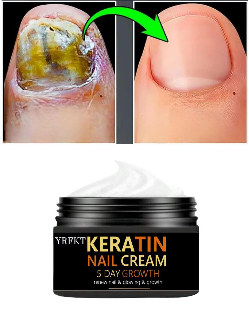 Keratin nail cream, hypoallergenic repair fingertip cream, promotes growth and restores nail health