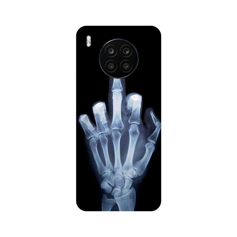 Custodia per Honor 50 Lite Calcio Custodia posteriore in silicone morbido per Honor 50 Lite Cover per telefono per Honor 50 9S 9A 9C 9X Lite etui Bumper