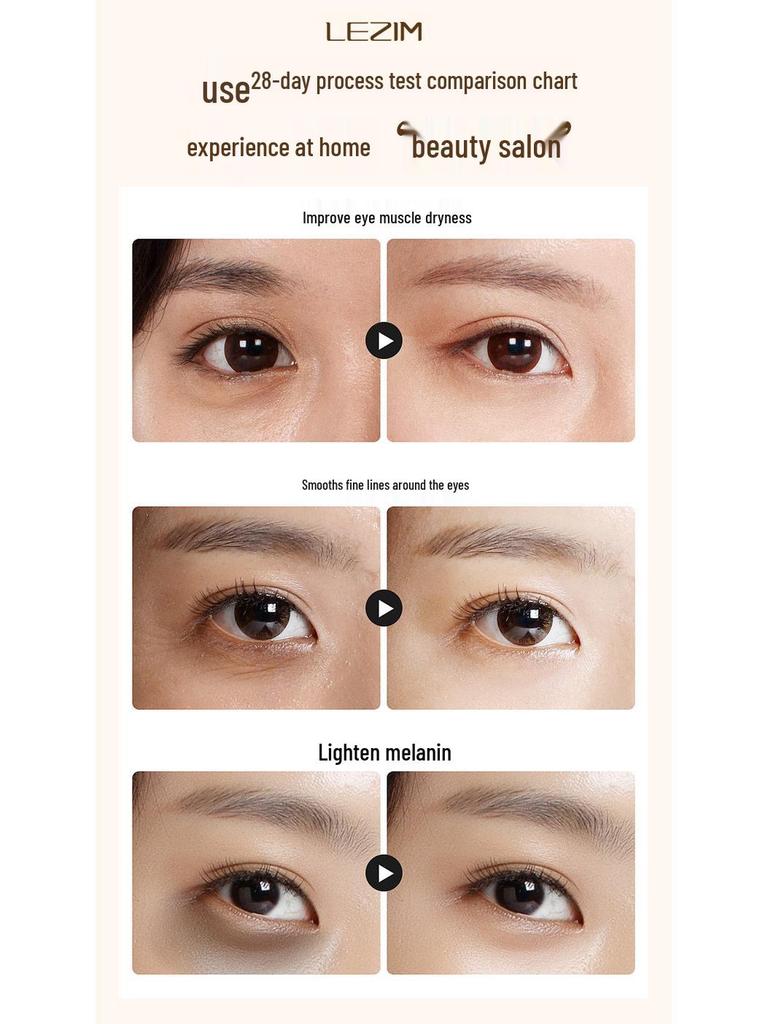 EMS Microcurrent 360° Eye Massager - Advanced Eye Care Device