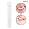 40pcs Dental Orthodontic Ligature Rubber Bands Teeth Corrector Elastic Brace