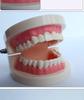 Human Tooth Anatomy Model for Teaching and Simulation - Detachable Denture Mold
