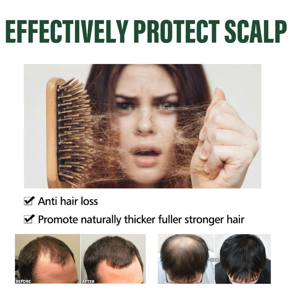 Huile d'Amla Originale Croissance des Cheveux Hydratante Lissante Réparateur Cheveux Abîmés Secs Frisés Pointes Fendues Traitement Cuir Chevelu Masque Capillaire Après-shampoing