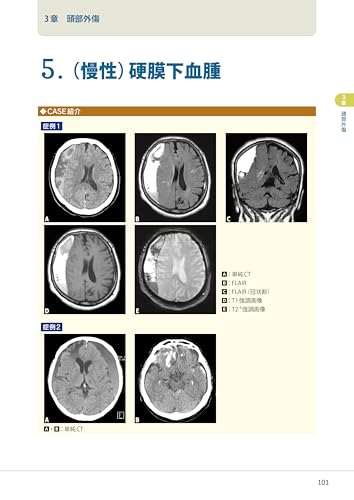 Mastering Head CT and MRI Imaging and Interpretation
