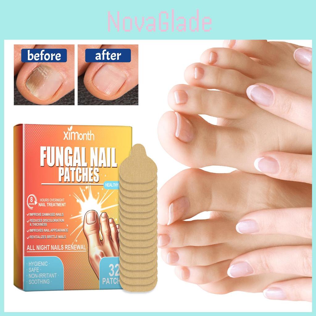 Ximonth Toenail Care Repair Patches For Repairing Protecting And Moisturizing Damaged Nails 32 Pcs