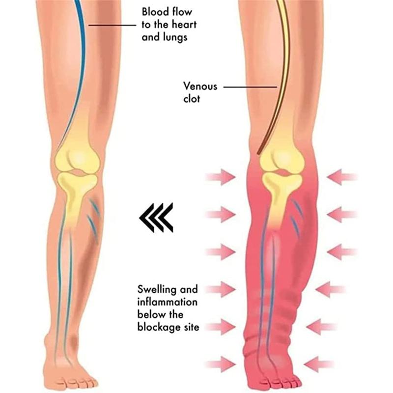 4Pcs Wide Open Magnetic Ring Adjusable Lymphatic Drainage Therapeutic Magnetic Ring Unisex for Adult Thanksgiving Gift