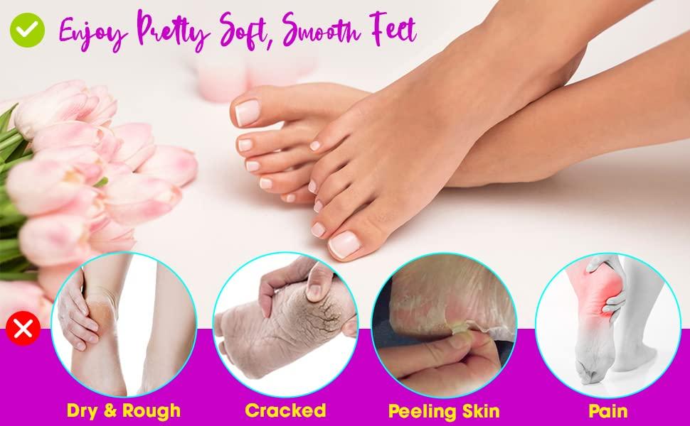 SAFERSKY Heel Pain Relief Silicone Gel Heel Socks Foot Protector anti crack heel socks Heel Protector Socks Silicon Toe Free Heel Pain Relief Soc