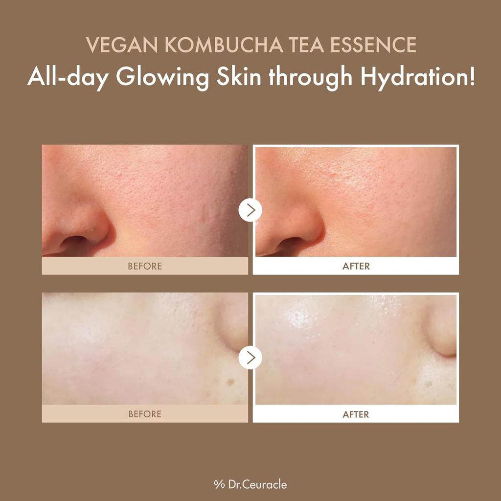 Dr.Ceuracle Vegan Kombucha Tea Essence