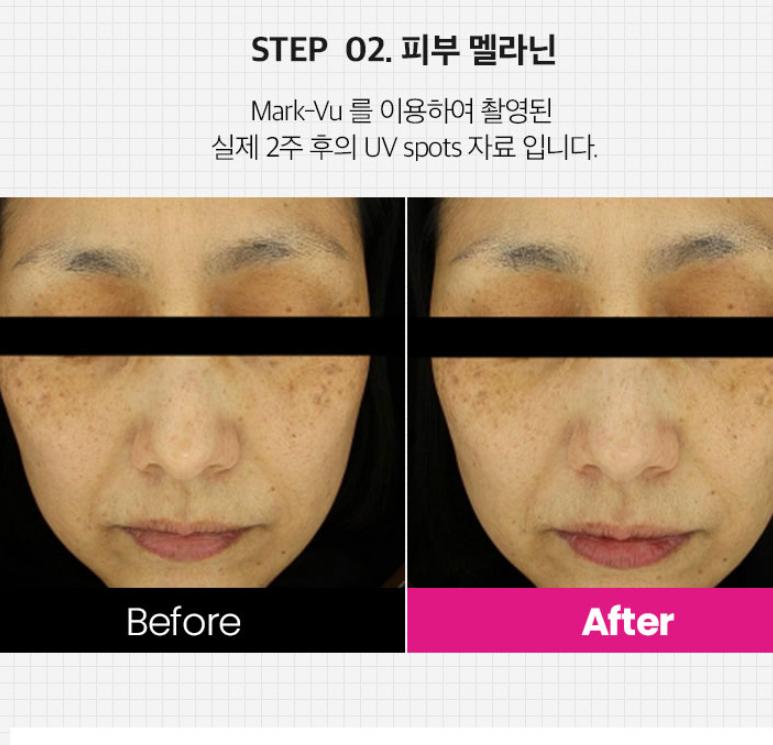 TOSOWOONG Arbutin 5% Whitening Cream 50g — Brightening & Moisturizing Care for Pigmentation and Wrinkles