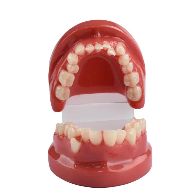 Dental Lab Teeth Malocclusion Model Demonstration Model for Training Studying Teaching Oral Model Dentistry Tools