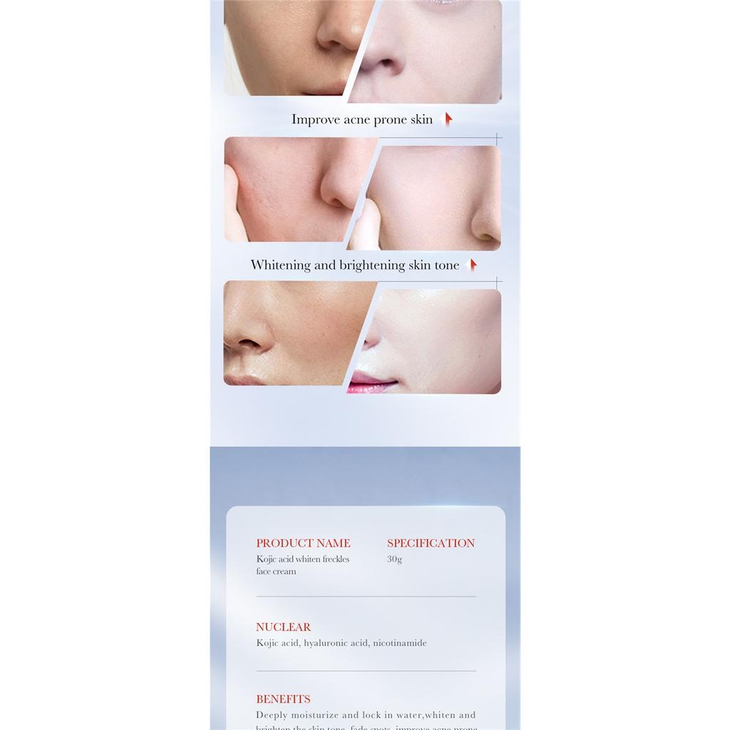 1/2pcs SADOER Kojic Acid Face Cream Moisturizing Freckle Removing Creams Brightening Hydrating Facial Cream Skin Care Products