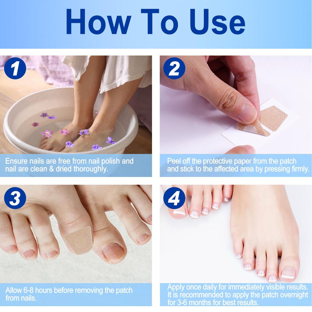 60pcs Nail Repairing Patches Reduce Discoloration Painless Nail Repair Treating Patches for Manicure