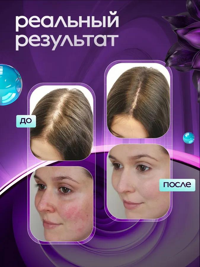 Darsonval, for Hair, Face and Body, with 6 Nozzles, Professional Apparatus