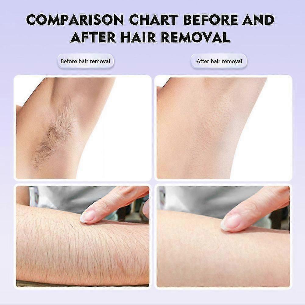 Women Face Epilator Facial Hair Removal for Women Smoothes Silky Wet/Dry Face Body Epilator