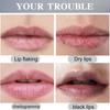 Lip Acne Cream, Fordyce Seeds - Lip Acne, Moisturizes, Improves Dry