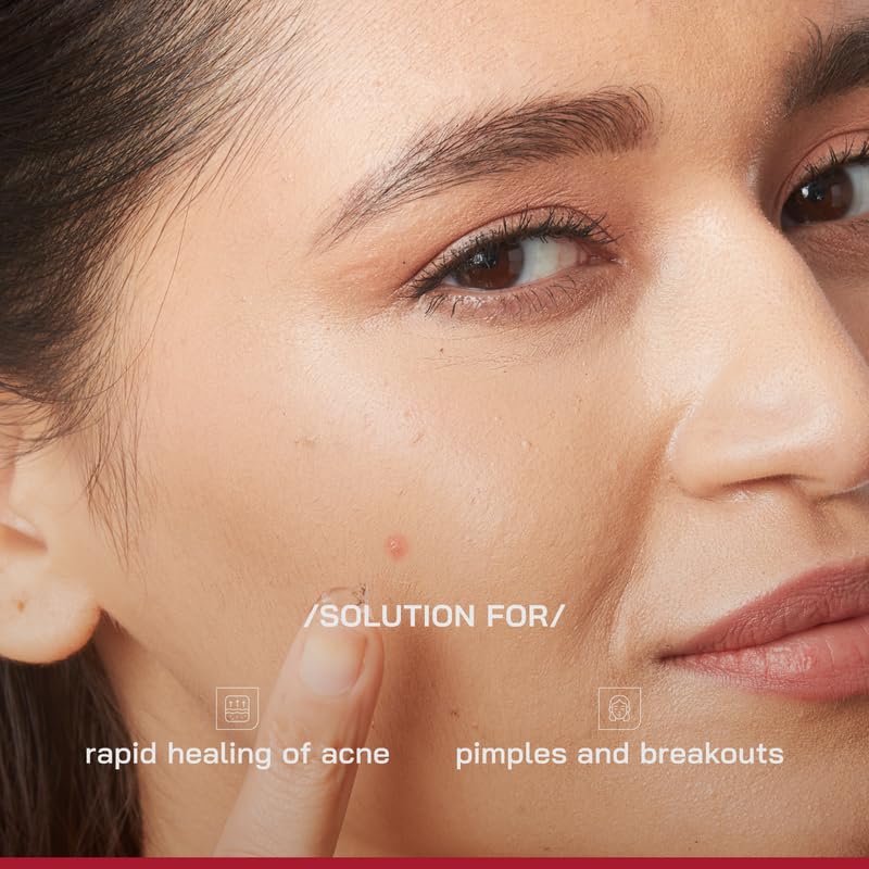 /PHD/ Salicylic Acid Acne Spot Treatment Gel 10g Pack of 3 | Fast-Acting Pimple Remover & Clear Skin Gel