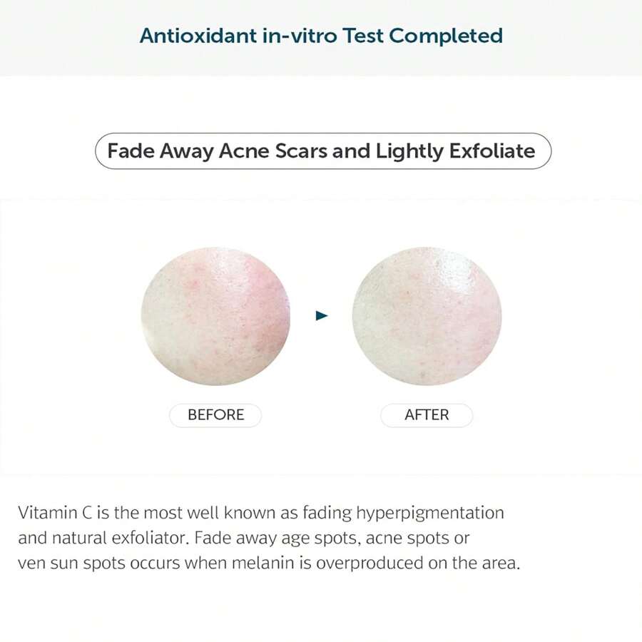 Dear, Klairs Freshly Juiced Vitamin Drop 5% Hypoallergenic Pure Vitamin C Serum 35ml | Ascorbic Acid, Antioxidant For Face