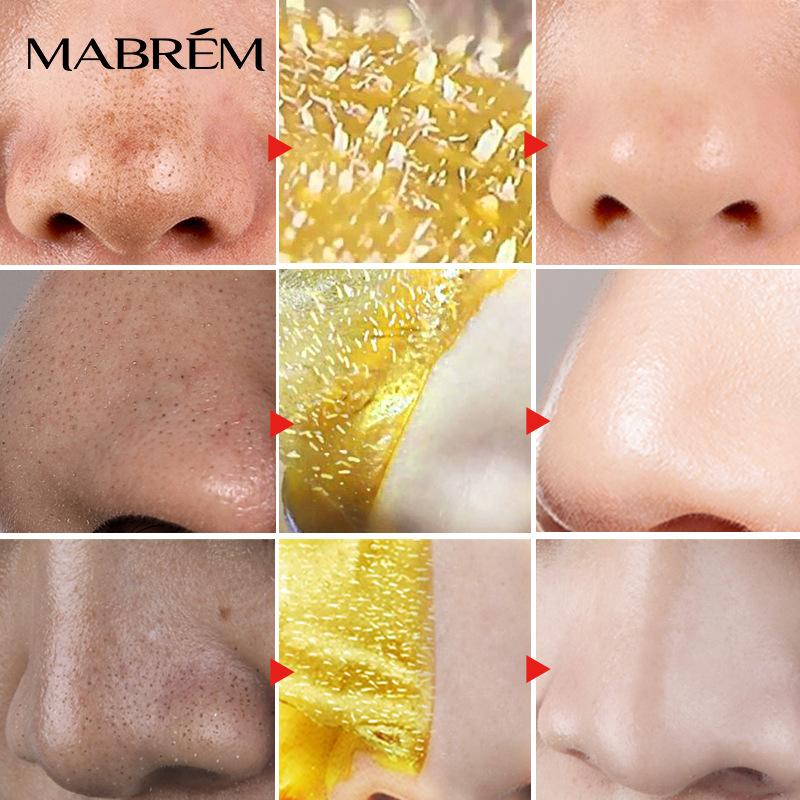 Gold Mask Blackhead Removal Tear Mask Whitening Cleansing Facial