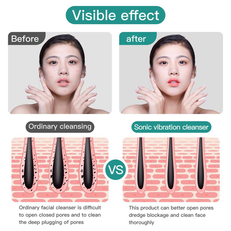 Electric Silicone Face Cleansing Brush Waterproof 2 In 1 Double Head, Sonic Vibration Facial Pore Cleaner Skincare Beauty Tool