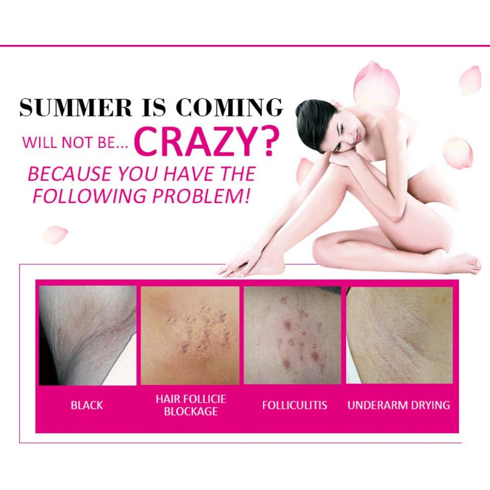 aichunArmpit cream, armpit brightening and hydrating cream, refreshing and non-greasy, body care cream, a whitening and moisturizing wonder