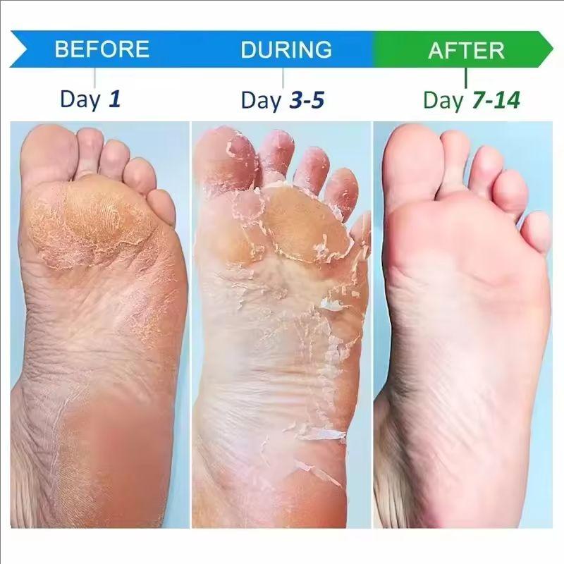 Crack Resistant Foot Cream, Heel Crack Repair Cream, Removes Dead Skin and Keratin, Softens, Moisturizes and Smooths Skin Care