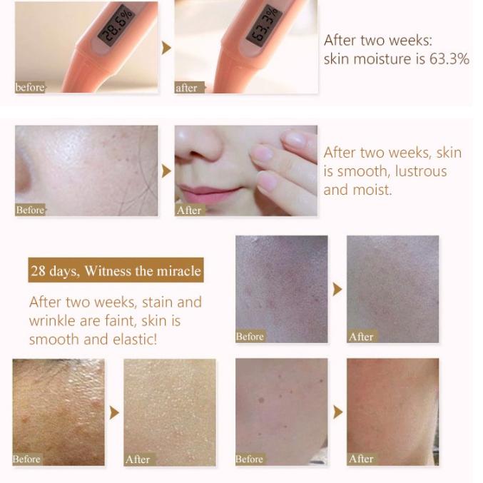 Купить Глиняная маска, грязевая маска для лица, очистка пор, удаление ...