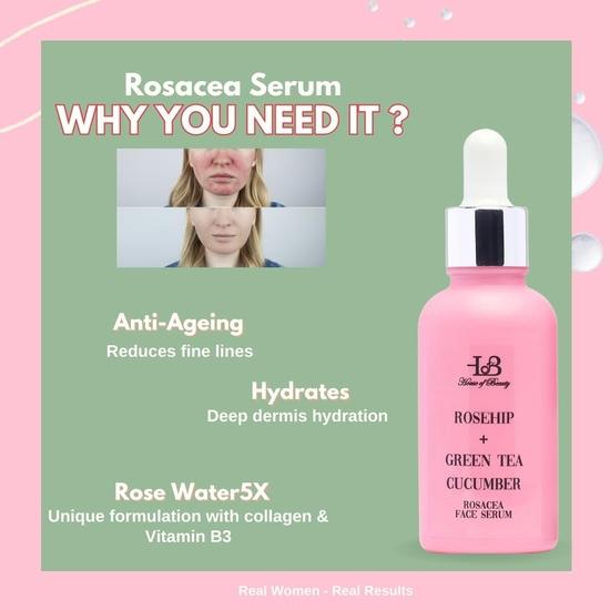 HOUSE OF BEAUTY Rosacea Serum - Rosehip, Green Tea, Cucumber for Face, Sensitive Skin Type, Redness, Dryness and Skin Stretching (30ml, Pack of 1)