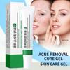 Akne Entfernung Creme Sommersprossen Creme Schrumpfen Poren Bleaching Feuchtigkeitsspendende Öl Kontrolle Akne Creme Hautpflege Akne Behandlung Gesichts Creme