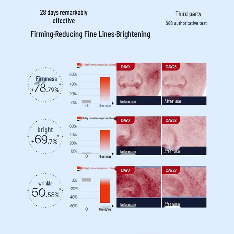 MESMOOTH Facial Rejuvenation & Anti-Wrinkle Device