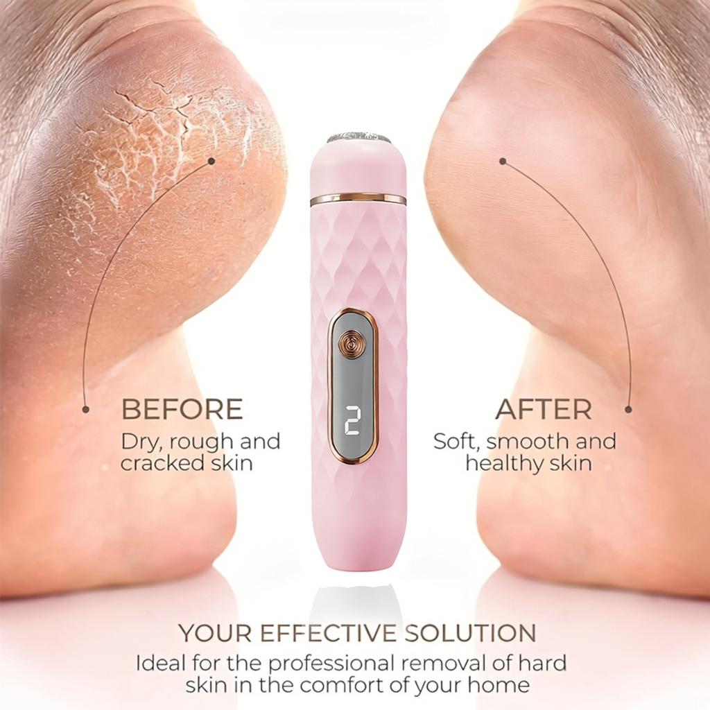 Household Electric Foot Grinder For Removing Dead Skin From The Feet Charging Model