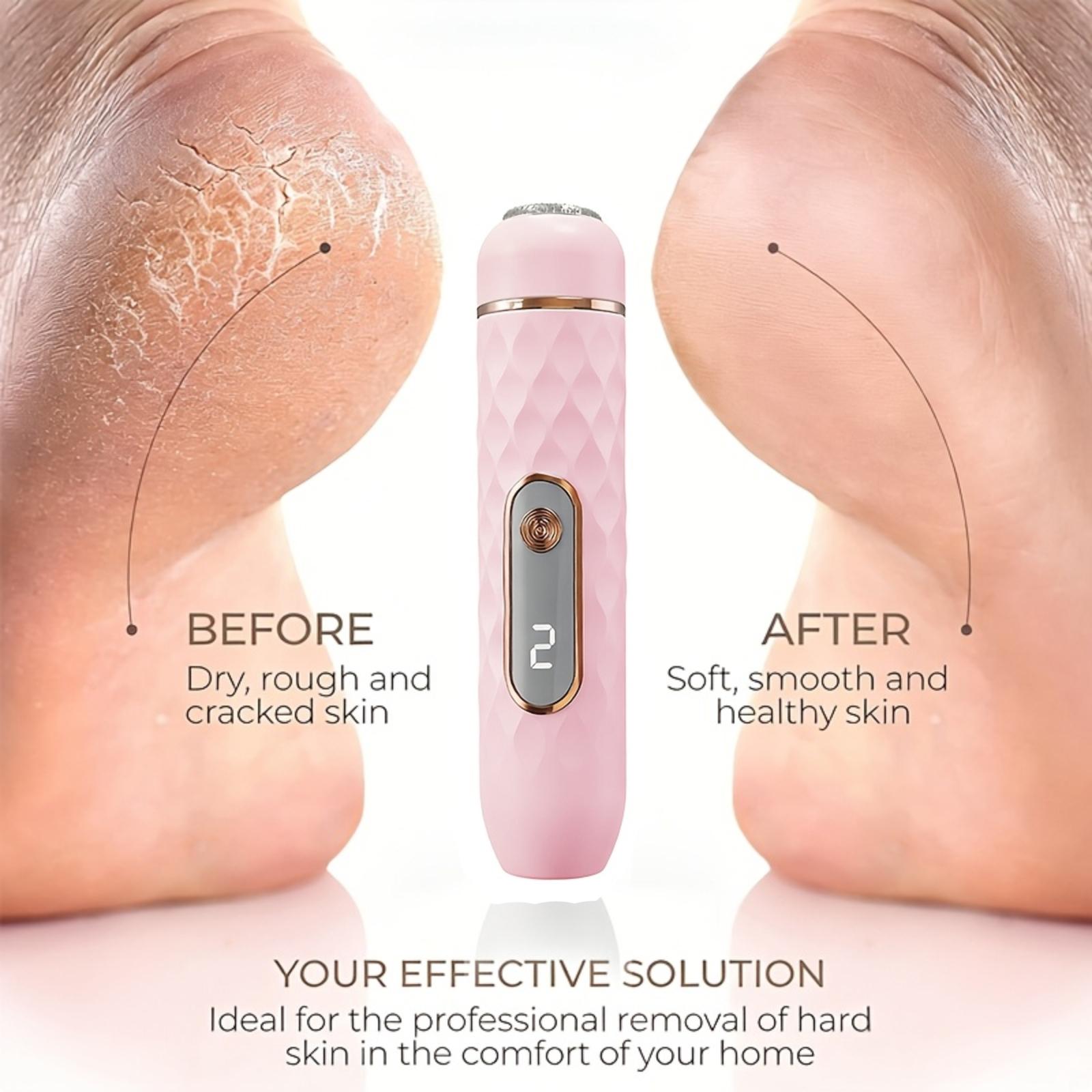 

Household Electric Foot Grinder For Removing Dead Skin From The Feet Charging Model One Size розовый