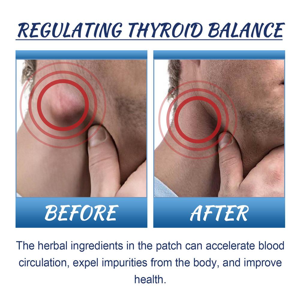 South Moon Lymphatic Patches Relieve Neck Stiffness And Ear Swelling 20pcs