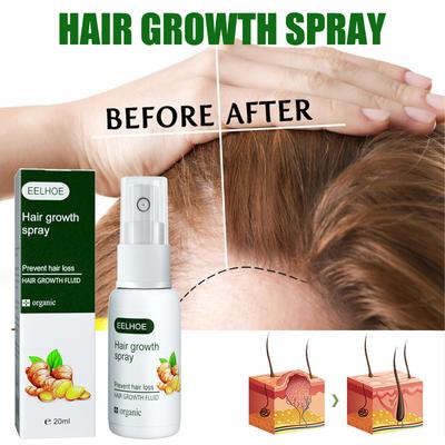 Cura di capelli e cuoio capelluto – Rimedi per la caduta dei capelli