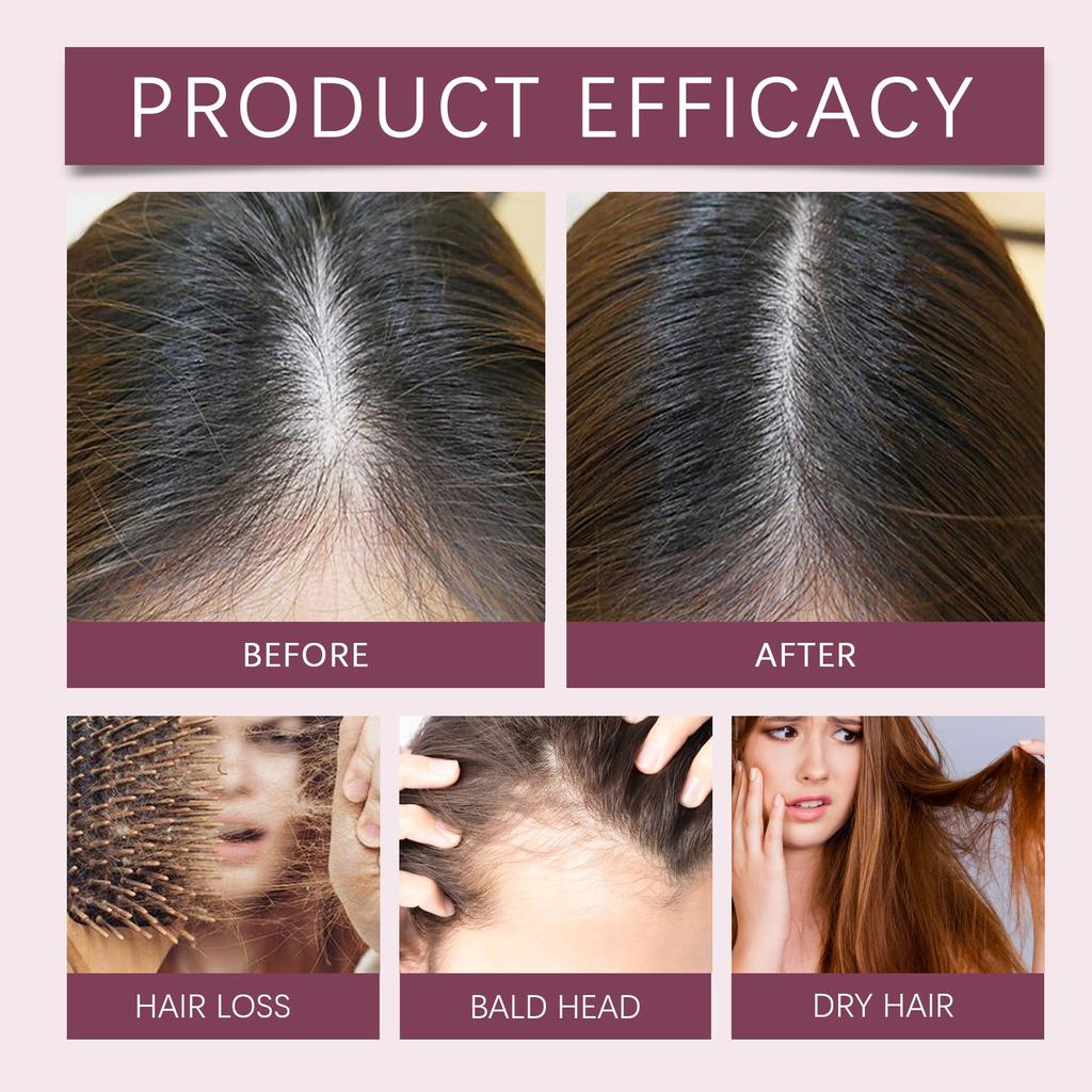 Huile de croissance des cheveux Stimule la croissance des cheveux Huile infusée d'huile, d'huile de ricin et d'huile de graine noire pour toutes les qualités de cheveux, 100 ml