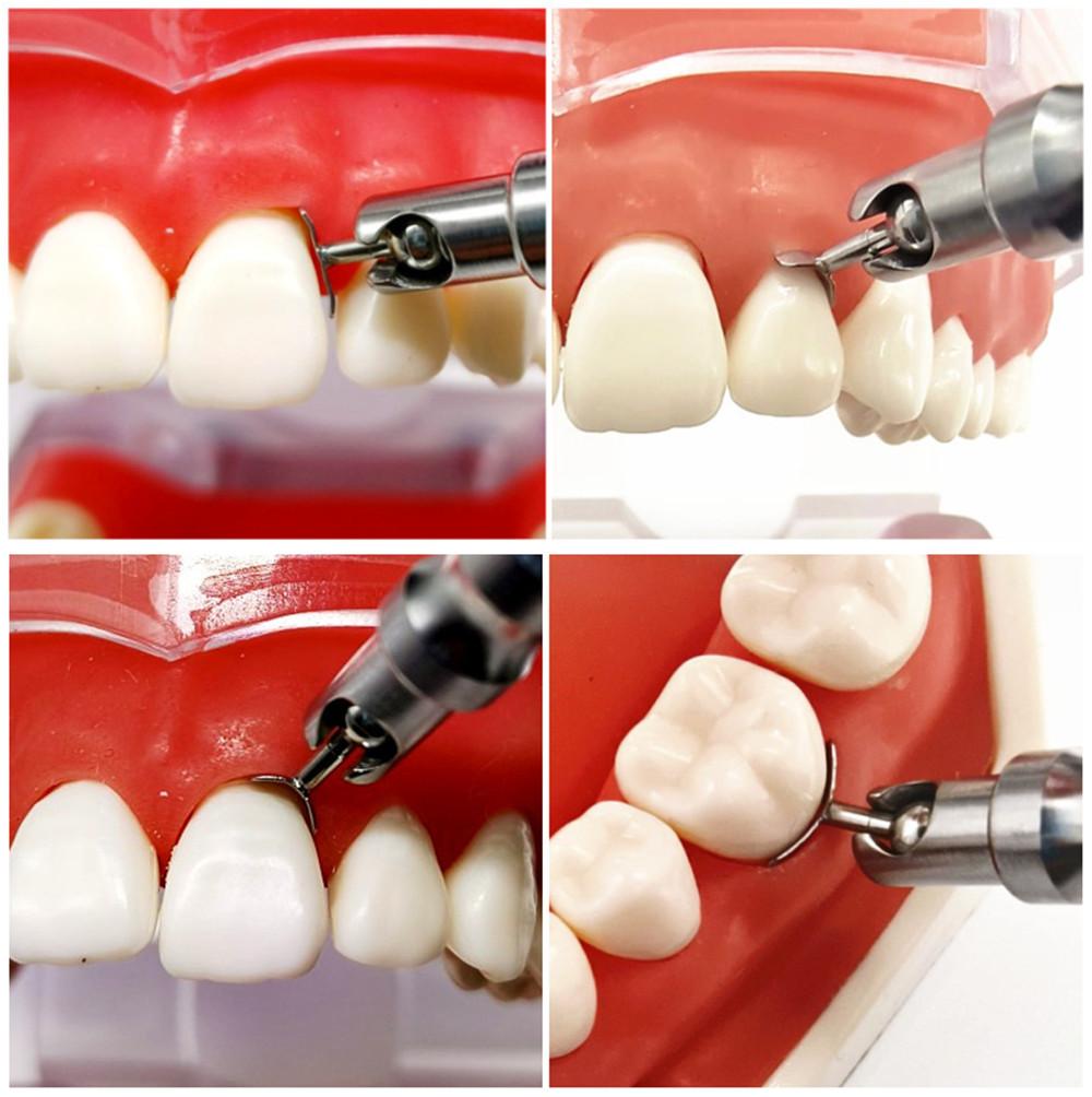 1 Set Adjustable Dental Implant Gingival Retraction Gingival Retractor Protector Gum Separator Isolation Tool