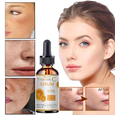 Retinol ve Hyaluronik Asit İçeren Ürünler Cilt Yenilenmesini Destekleyebilir, Kırışıklıkları ve İnce Çizgileri Azaltabilir