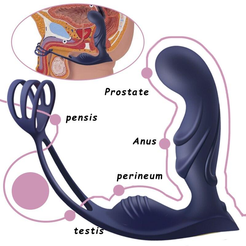 Männlicher Prostata-Massage-Vibrator, Butt-Plug, Silikon-Stimulationsring, Vibrator, verzögerte Ejakulation, männliches Sexspielzeug