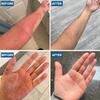 C+ Eczema Cream for Adults - Lotion for Extremely Dry Skin, Inflammation, Redness, Itch Relief & Dermatitis - Manuka Honey & Calendula - Clinically