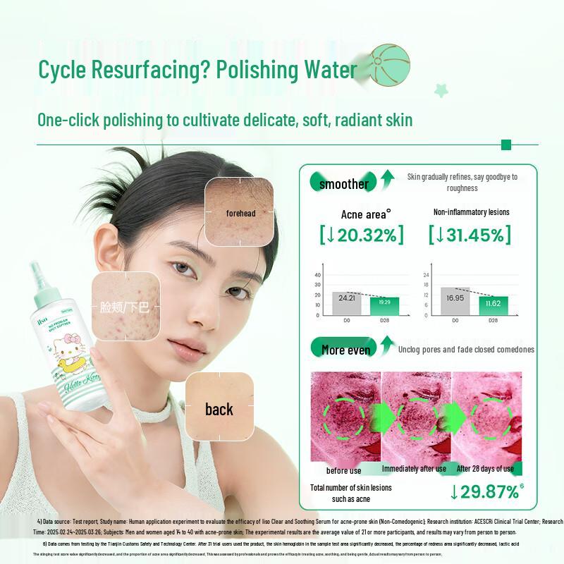 ilso Hello Kitty Soothing Acne Treatment Essence Water