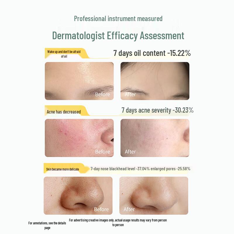 Kangaroo Mom Teen Clarifying Facial Cleanser