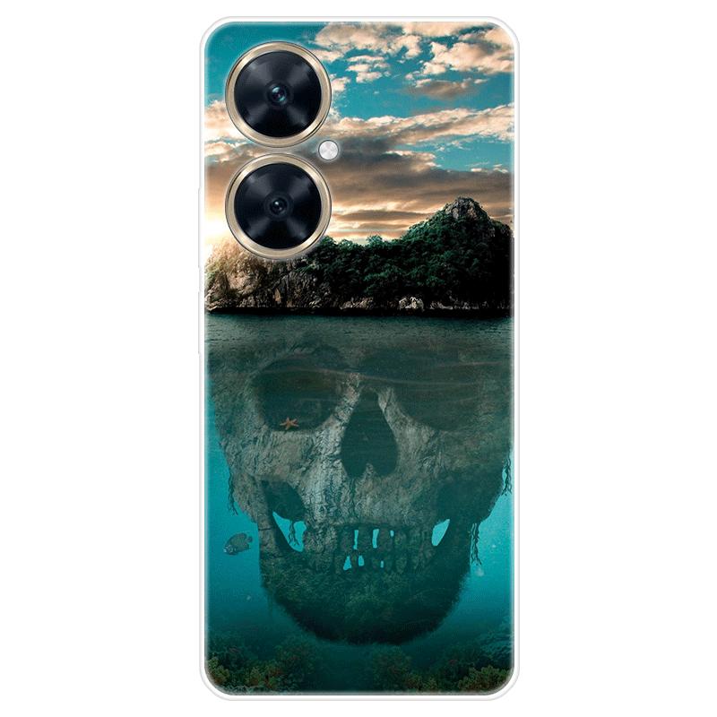 Für Huawei nova 11i nova11i Fall Weiche Silikon Zurück Abdeckung Cartoon Telefon Fall Diversifizierung