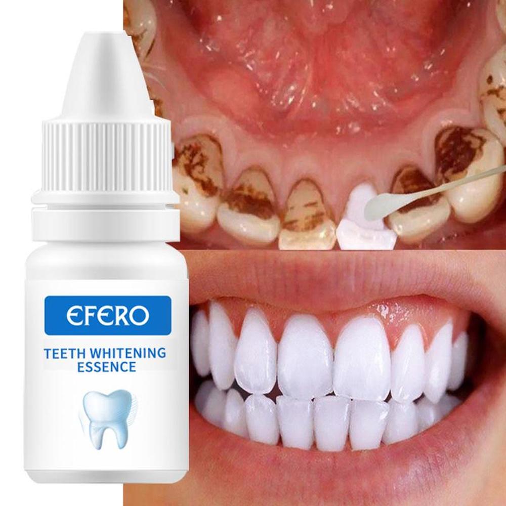Teeth Whitening Essence Removes Plaque Stains Teeth Cleaning Whitening Oral Hygiene Care