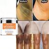 Whitening Cream Private Parts Whitening Bleaching Face Body Lightening Cream Underarm Armpit Whitening Cream Legs Knees