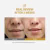 2026#1/2/3/4/5x Korean AntiAging Serum with Silk Peptide Collagen Boost, Instant Lifting and 72H Hydration