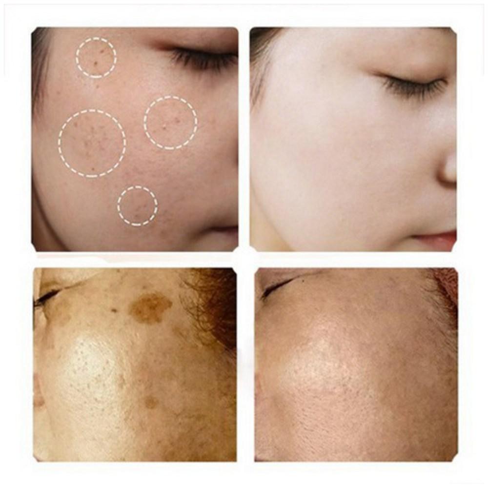 Ampoule éclaircissante Spot Ampoule d'essence blanchissante Élimine les taches de rousseur et les taches de vieillesse, améliore la pigmentation du visage, 30 ml, 1 pièce