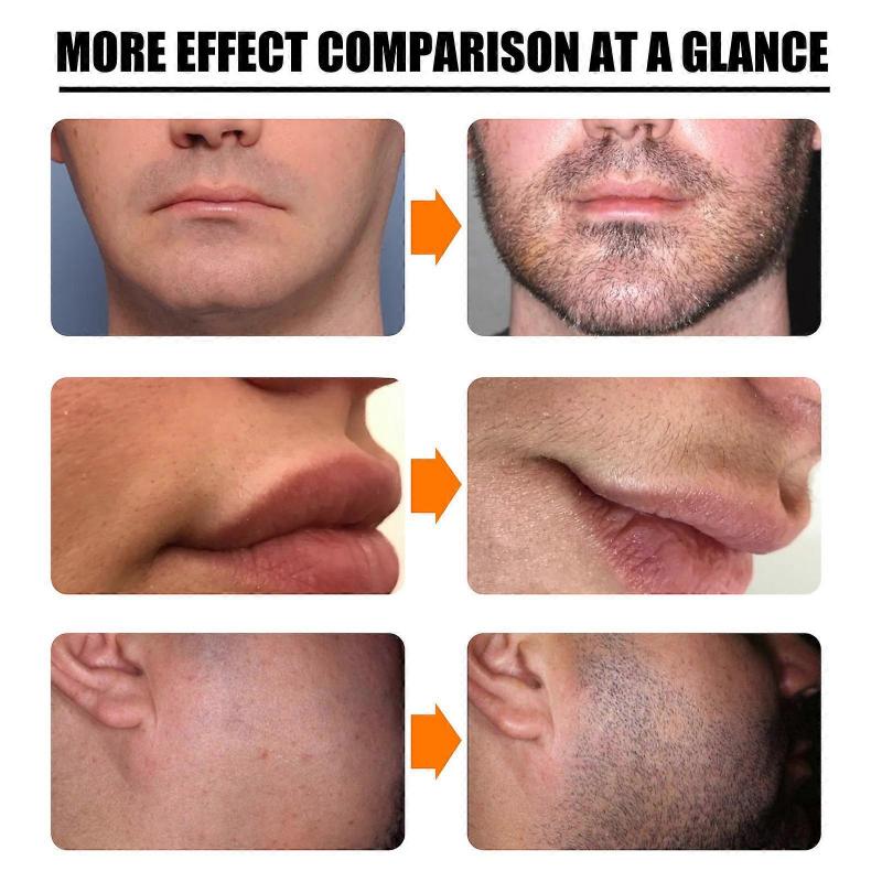 Natürliches Bartwuchs-Roller-Kit für Männer mit nährendem Bartwuchsöl & Anti-Haarausfall-Spray