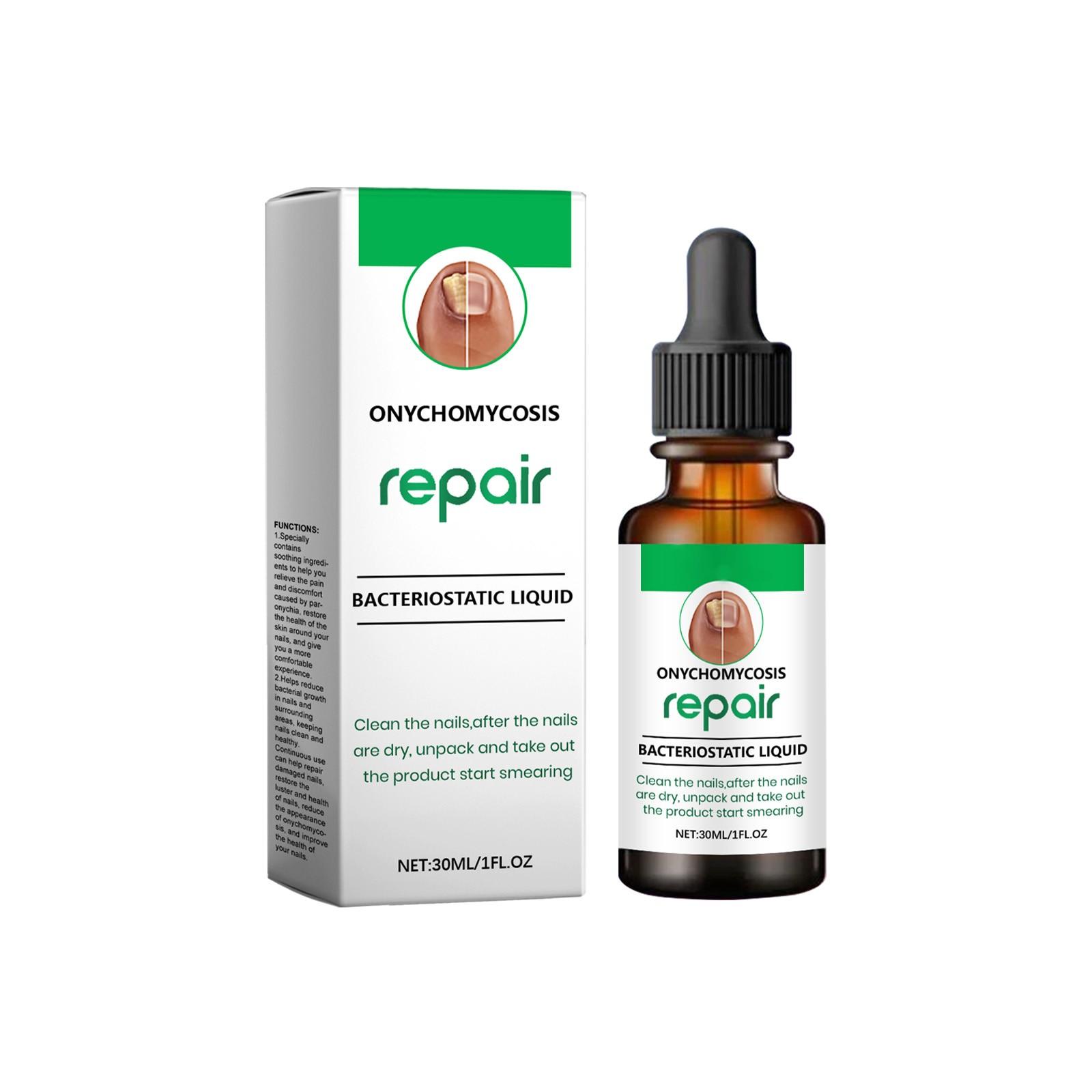 

Масло для роста ногтей Leuconychia Масло для ногтей Mycosis Care For Nail Mycosis Foot Mycosis Red Brown Foot 30ML One size зелёный