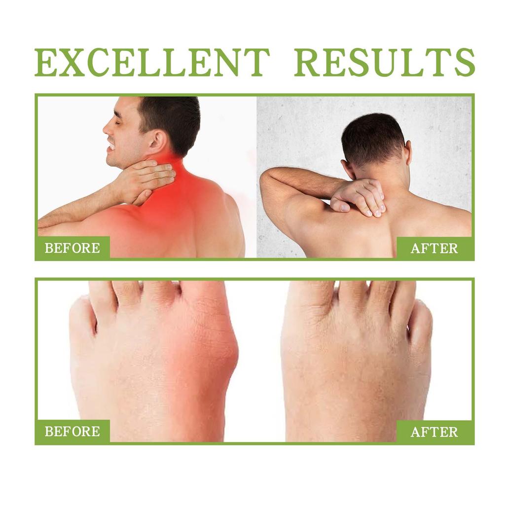 XIMONTH Joint and Muscle Care Gel Cold Compress Relief for Muscle and Joint Pain 100g