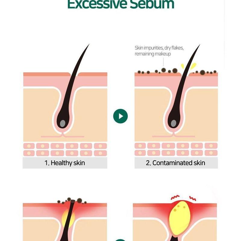 SOME BY MI - AHA,BHA,PHA 30 Days Miracle Acne Clear Foam Mini