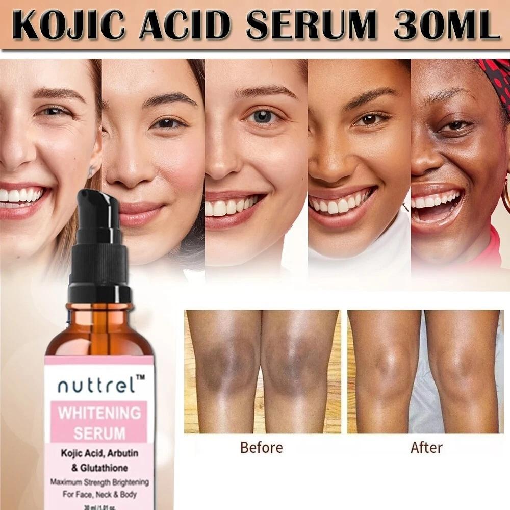 Multifunctional Facial Serum with Kojic Acid, Arbutin and Glutathione Dark Skin Whitening and Dark Spot Brightening 30ml