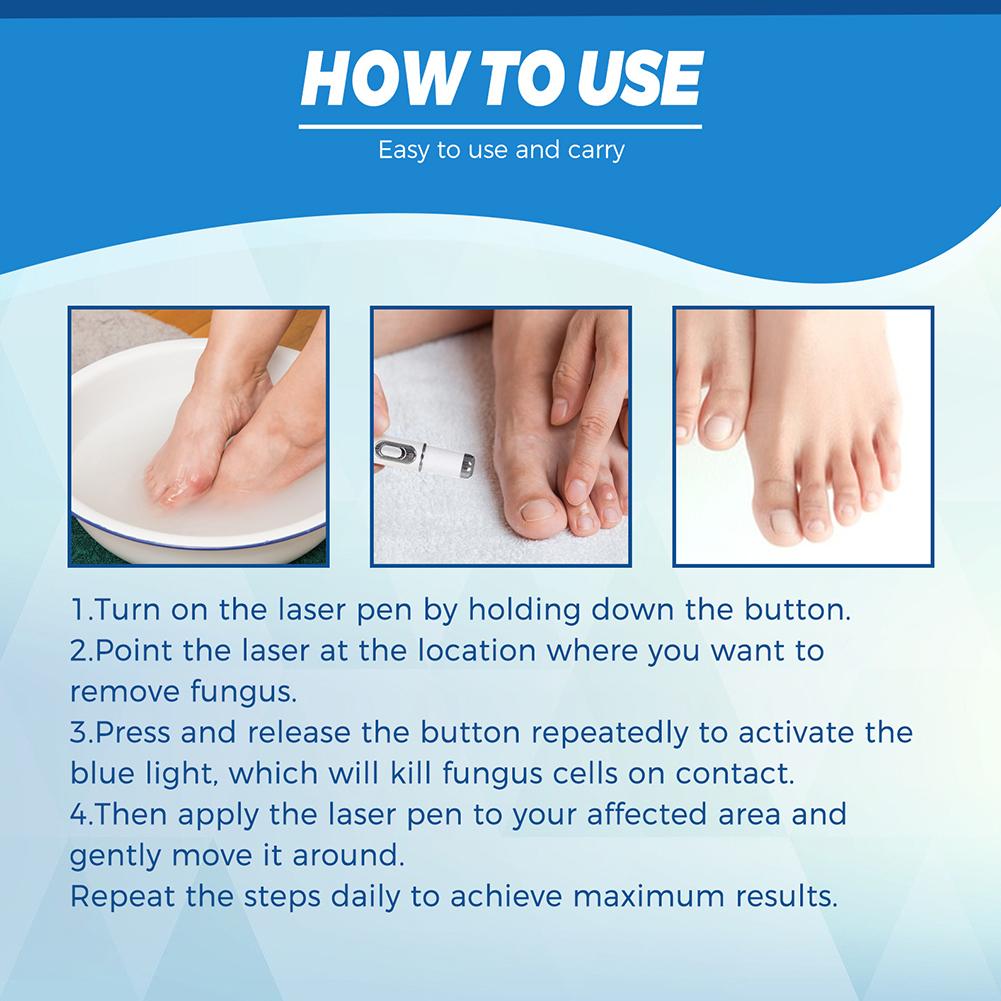 Nail Fungus Laser Cure Machine Foot Care Device for Nail Treatments Anti Infection Paronychia Onychomycosis Nail Removal Care